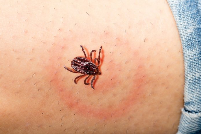 lyme-kór
