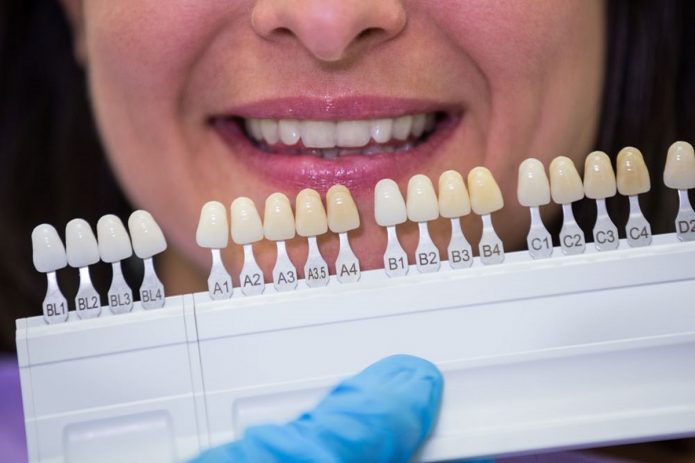 milyen fogkoronát válasszak, a Dentpoint Implantológiai és Parodontológiai Centrum