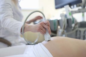PCOS esetén időzíteni is jól kell. Fotó: Freepik.