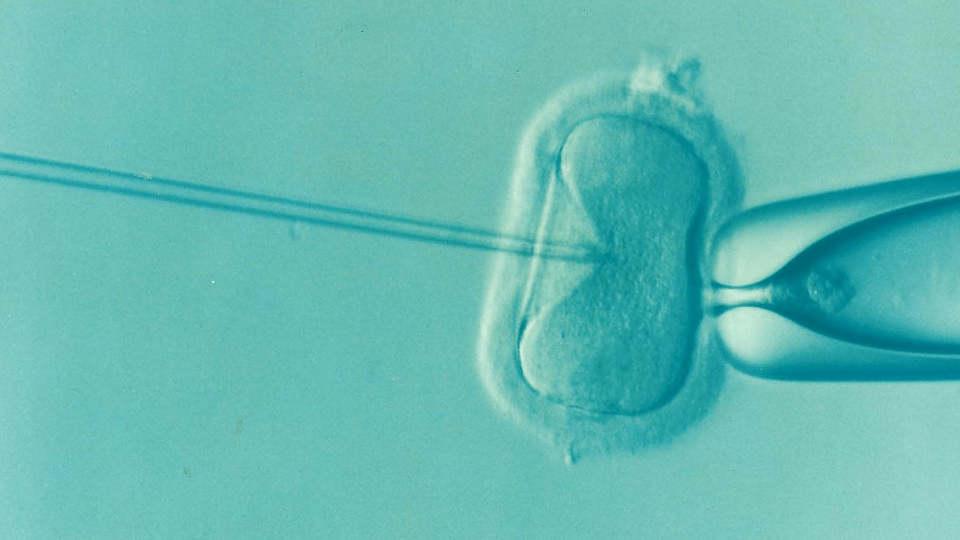 ivf_mesterséges megtermékenyítés